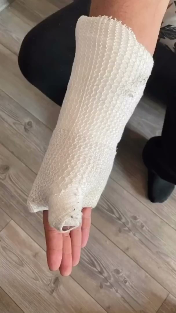 Erneuter Fall von Polizeigewalt in Essen