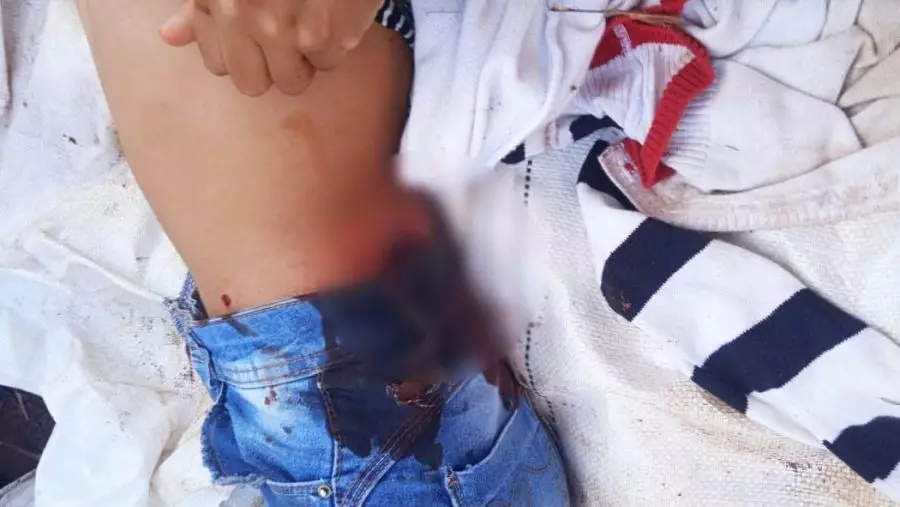 Brasilien: “Dringend: Schocktruppe schlachtet Guarani Kaiowá Jugendliche in Amambai, MS”