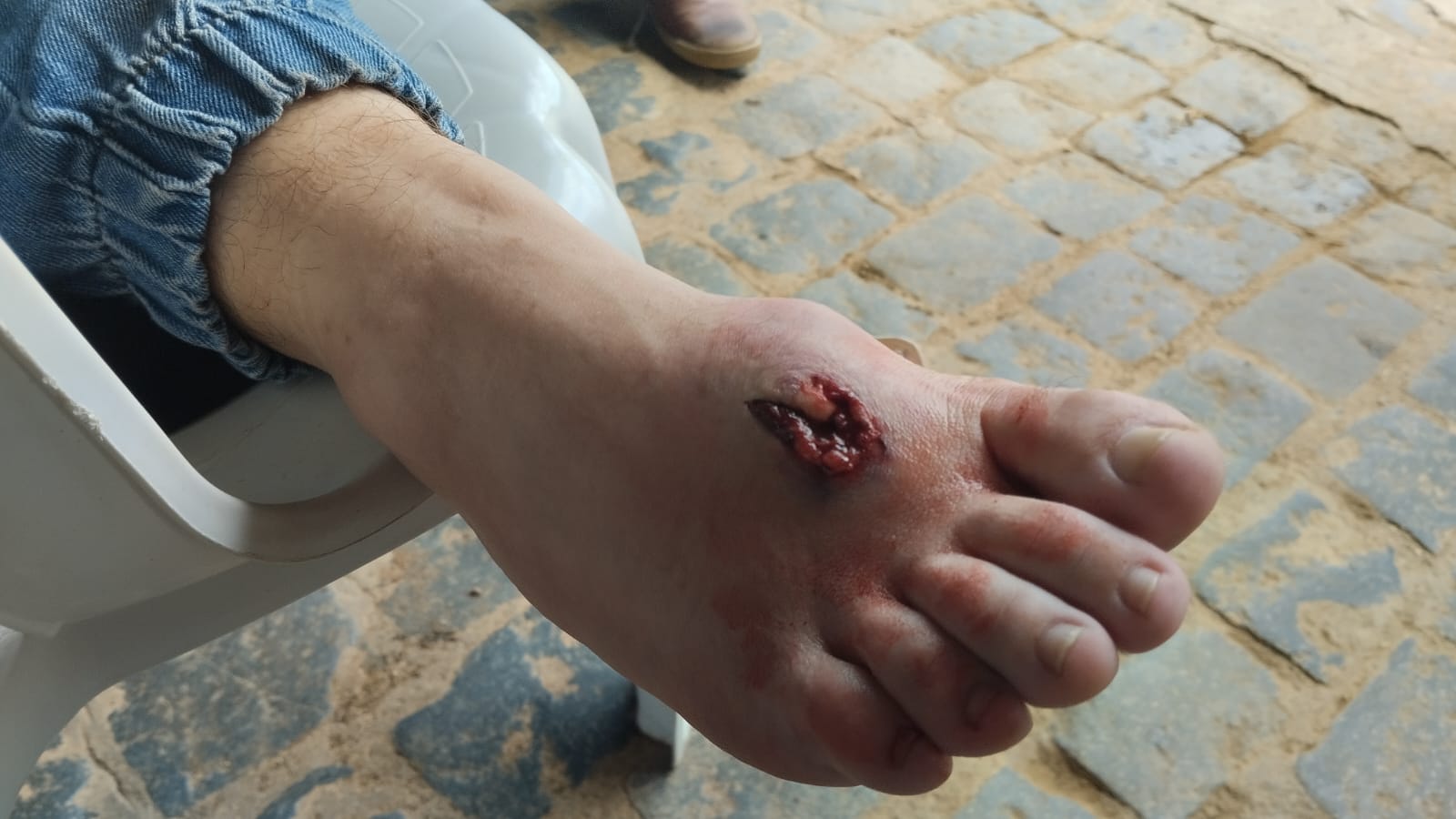 Brasilien: Die Rolle der Frauen in dem erbitterten Kampf von Barro Branco